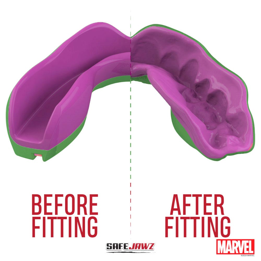 SAFEJAWZ Gebitsbeschermer - Extro Marvel Hulk - Groen - Afbeelding 6