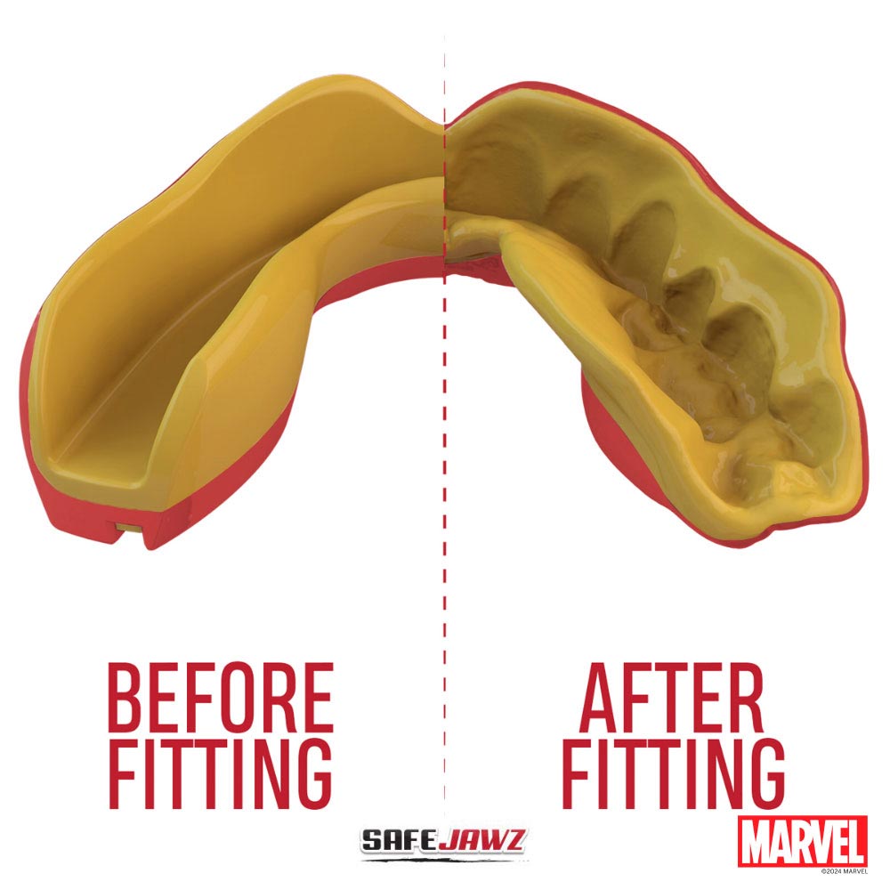 SAFEJAWZ Gebitsbeschermer - Extro Marvel Iron Man - Rood / Goud - Afbeelding 6